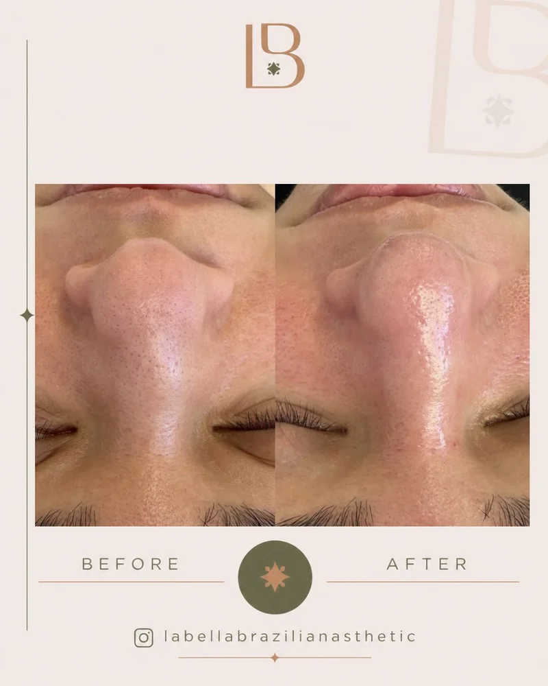 Before and after facial treatment, close up